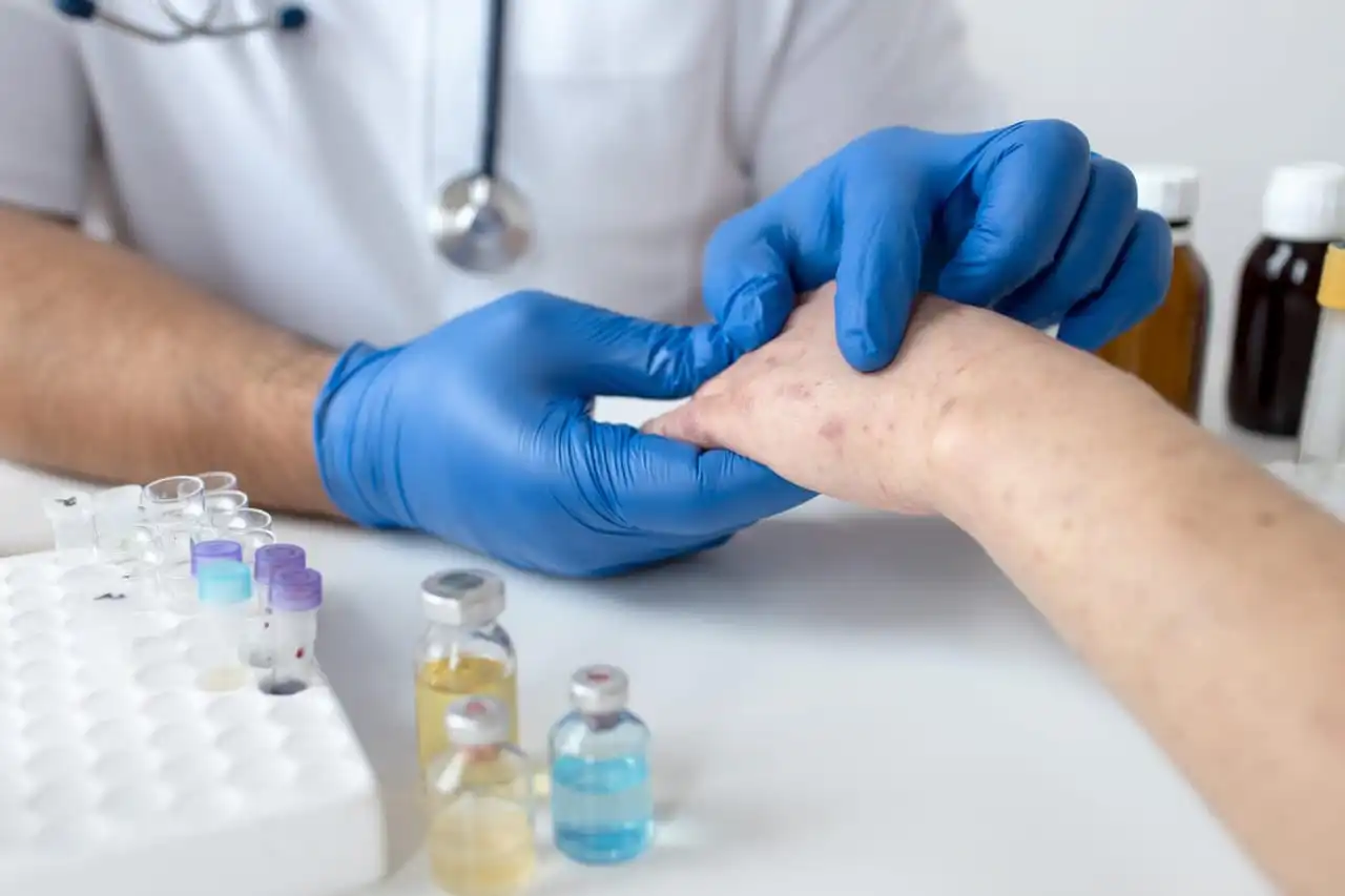 Exploring Fungal Infections: Types, Symptoms, and Effective Treatments
