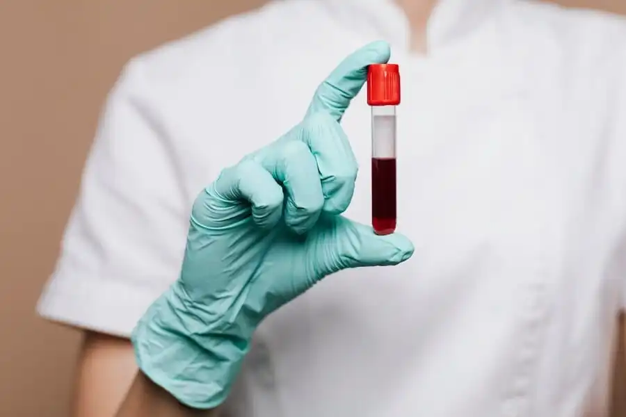 Blood Tests: Types, Names, and Their Significance