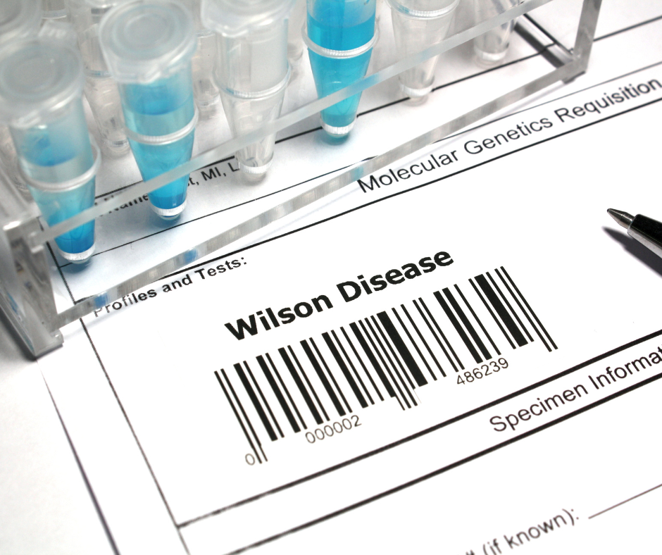 What is Wilson's Disease (Disorder): Symptoms, Treatment and Causes