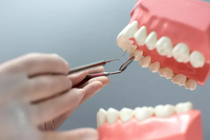 Wisdom Teeth: Function, Location & Anatomy
