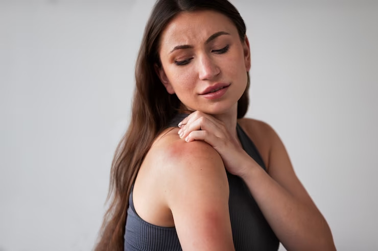 Heat Rash - Types, Symptoms, Causes and Treatment